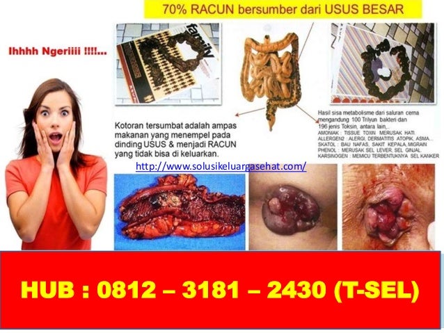 cara mengecilkan perut buncit dengan cepat tanpa olahraga