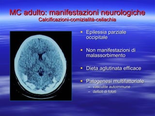 MC adulto: manifestazioni neurologiche Calcificazioni-comizialità-celiachia Epilessia parziale occipitale Non manifestazioni di malassorbimento  Dieta aglutinata efficace Patogenesi multifattoriale vasculite autoimmune deficit di folati 