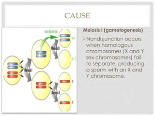CAUSE
Meiosis I (gametogenesis)
Nondisjunction occurs
when homologous
chromosomes (X and Y
sex chromosomes) fail
to separate, producing
a sperm with an X and
Y chromosome.
 