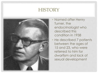 HISTORY
• Named after Henry
Turner, the
endocrinologist who
described this
condition in 1938
• He described 7 patients
between the ages of
15 and 23, who were
referred to him for
dwarfism and lack of
sexual development
 