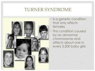 TURNER SYNDROME
• Is a genetic condition
that only affects
females
• This condition caused
by an abnormal
chromosome and
affects about one in
every 2,500 baby girls
 