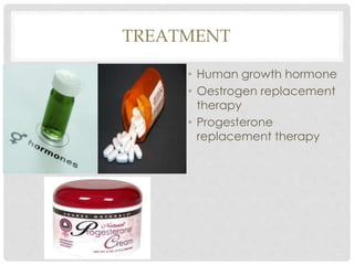 TREATMENT
• Human growth hormone
• Oestrogen replacement
therapy
• Progesterone
replacement therapy
 