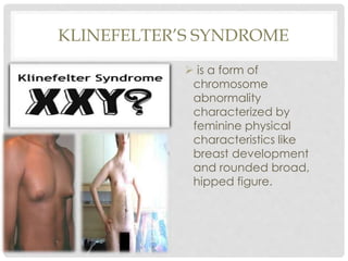 KLINEFELTER’S SYNDROME
 is a form of
chromosome
abnormality
characterized by
feminine physical
characteristics like
breast development
and rounded broad,
hipped figure.
 