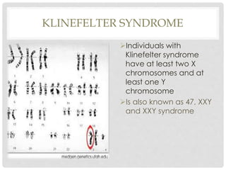 KLINEFELTER SYNDROME
Individuals with
Klinefelter syndrome
have at least two X
chromosomes and at
least one Y
chromosome
Is also known as 47, XXY
and XXY syndrome
 