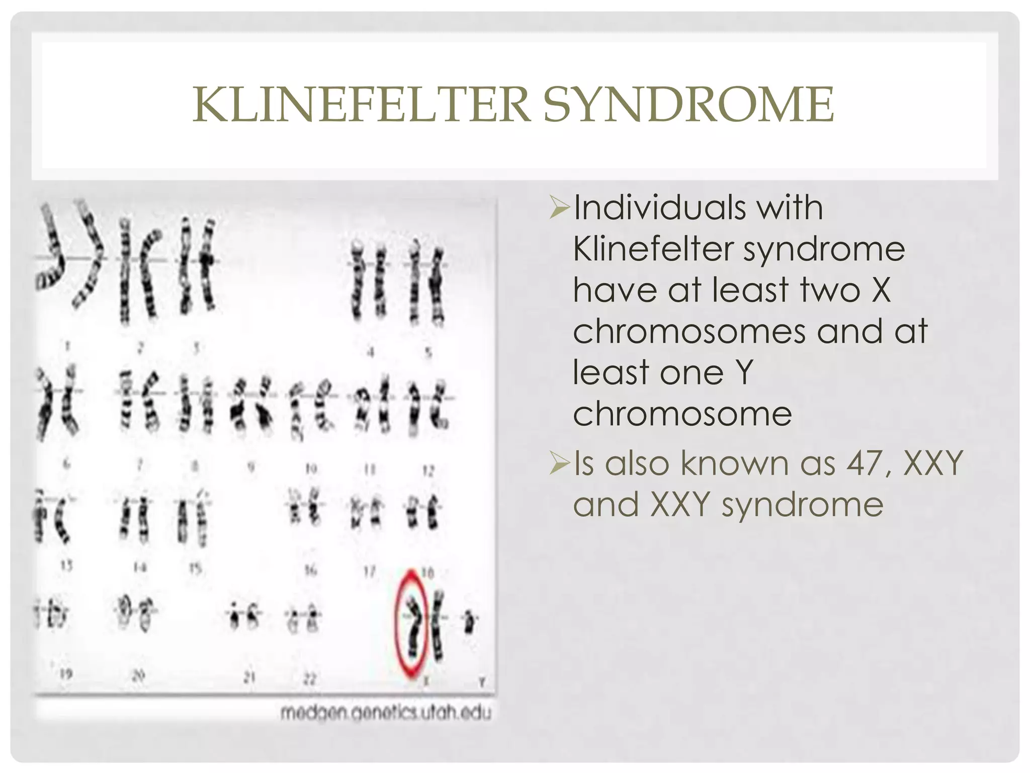 Pervasive Developmental Disorders turner Syndrome Klinefelter s 