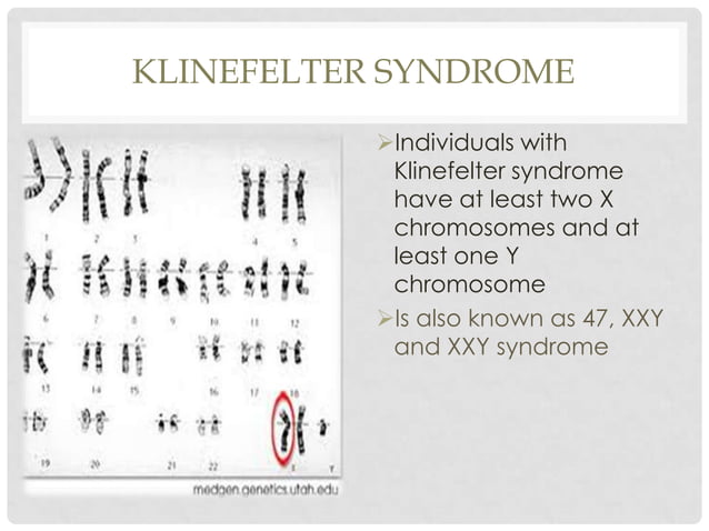 Pervasive developmental disorders (turner syndrome, klinefelter's syn…