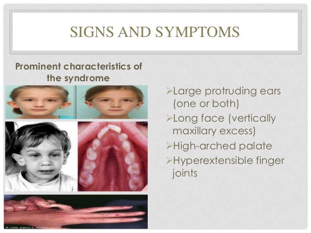 Pervasive developmental disorders (turner syndrome, klinefelter's syn…
