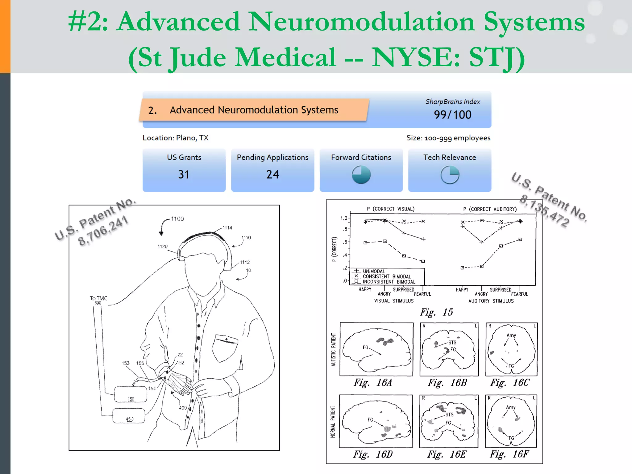 #2: Advanced Neuromodulation Systems
(St Jude Medical -- NYSE: STJ)