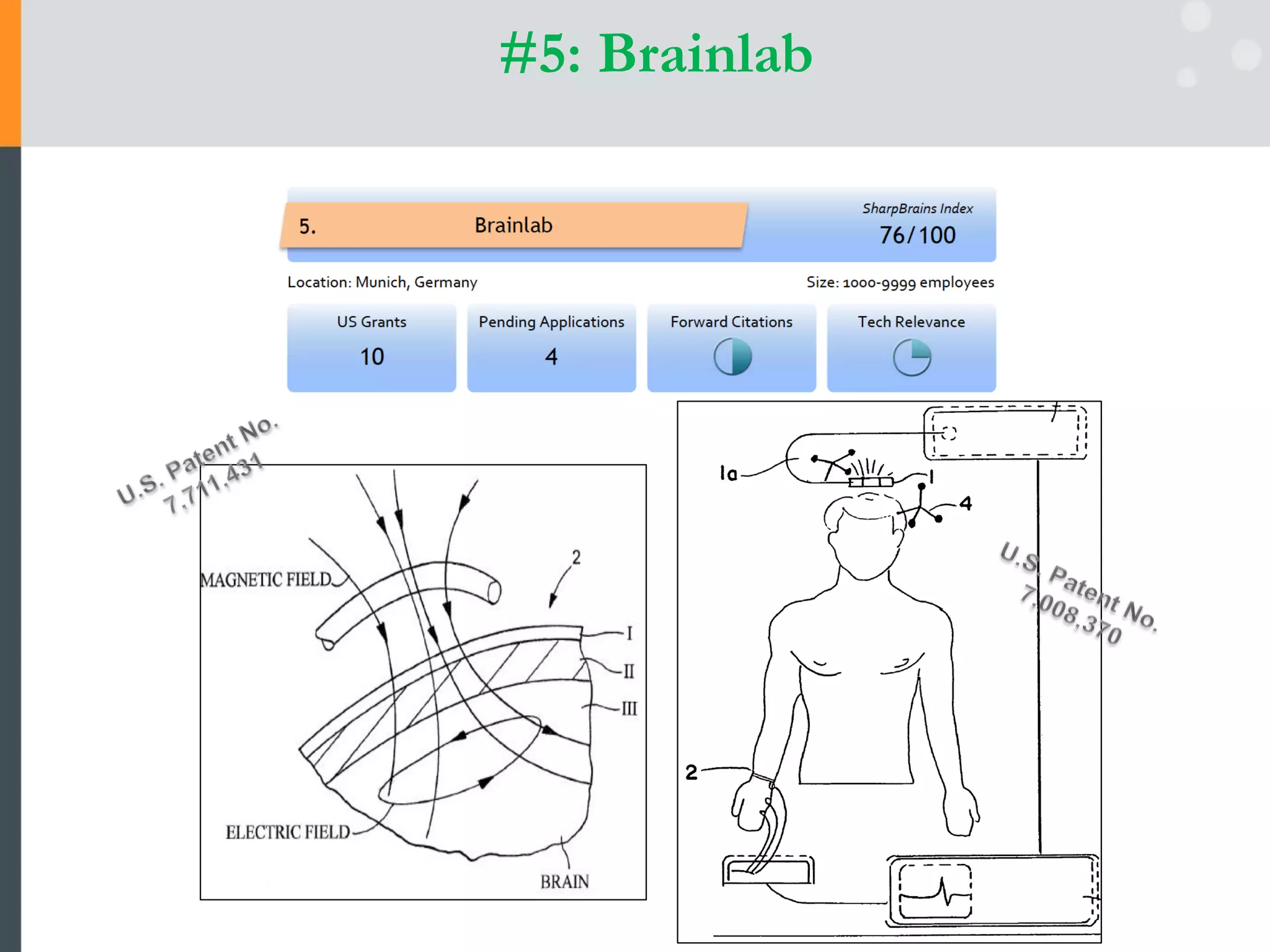 #5: Brainlab