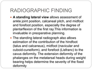 RADIOGRAPHIC FINDING
 A standing lateral view allows assessment of
ankle joint position, calcaneal pitch, and midfoot
and forefoot position, especially the degree of
plantarflexion of the first ray.This information is
invaluable in preoperative planning.
 The standing lateral radiograph also allows
estimation of the contribution of the hindfoot
(talus and calcaneus), midfoot (navicular and
cuboid-cuneiform), and forefoot (Lisfranc) to the
cavus deformity. The extension deformity of the
phalanges on the metatarsal heads during weight
bearing helps determine the severity of the fixed
deformity
 