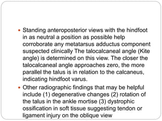 Standing anteroposterior views with the hindfoot
in as neutral a position as possible help
corroborate any metatarsus adductus component
suspected clinically The talocalcaneal angle (Kite
angle) is determined on this view. The closer the
talocalcaneal angle approaches zero, the more
parallel the talus is in relation to the calcaneus,
indicating hindfoot varus.
 Other radiographic findings that may be helpful
include (1) degenerative changes (2) rotation of
the talus in the ankle mortise (3) dystrophic
ossification in soft tissue suggesting tendon or
ligament injury on the oblique view
 