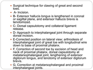  Surgical technique for clawing of great and second
toes.
 A- Incision.
 B- Extensor hallucis longus is lengthened in coronal
or sagittal plane, and extensor hallucis brevis is
tenotomized.
 C- Dorsal capsulotomy and collateral ligament
release.
 D- Approach to interphalangeal joint through separate
dorsal incision.
 E-Corrected position on lateral view; arthrodesis of
interphalangeal joint of great toe with longitudinal wire
down to base of proximal phalanx.
 F, Correction of second toe by excision of head and
neck of proximal phalanx, dorsal capsulotomy at
metatarsophalangeal joint, lengthening of extensor
digitorum longus, and tenotomy of extensor digitorum
brevis.
 G, Correction at metatarsophalangeal and proximal
interphalangeal joints.
 