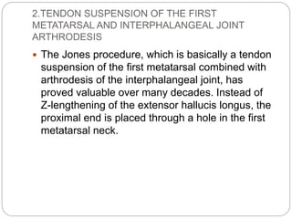 2.TENDON SUSPENSION OF THE FIRST
METATARSAL AND INTERPHALANGEAL JOINT
ARTHRODESIS
 The Jones procedure, which is basically a tendon
suspension of the first metatarsal combined with
arthrodesis of the interphalangeal joint, has
proved valuable over many decades. Instead of
Z-lengthening of the extensor hallucis longus, the
proximal end is placed through a hole in the first
metatarsal neck.
 