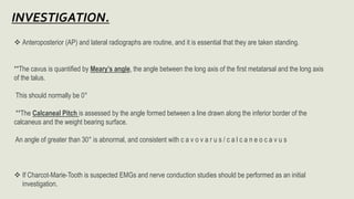 Anteroposterior (AP) and lateral radiographs are routine, and it is essential that they are taken standing.
**The cavus is quantified by Meary’s angle, the angle between the long axis of the first metatarsal and the long axis
of the talus.
This should normally be 0°
**The Calcaneal Pitch is assessed by the angle formed between a line drawn along the inferior border of the
calcaneus and the weight bearing surface.
An angle of greater than 30° is abnormal, and consistent with c a v o v a r u s / c a l c a n e o c a v u s
 If Charcot-Marie-Tooth is suspected EMGs and nerve conduction studies should be performed as an initial
investigation.
 