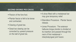 SECOND DEGREE PES CAVUS
 Flexion of the fore foot.
 Plantar fascia is felt to be tense
and contracted.
 Clawing of great toe.
 Great toe clawing can be
corrected by upward pressure
on the ball of great toe.
RX
 A shoe fitted with a metatarsal bar
may give temporary relief.
 Stiendlers Procedure : Plantar fascia
release.
 Jones Procedure : The extensor
halluces longus tendon is divided at
its insertion and passed through the
neck of first metatarsal +
interphalyngeal joint fusion.
 