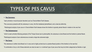 TYPES OF PES CAVUS
 Pes Cavovarus :
*seen primarily in neuromuscular disorders such as Charcot-Marie-Tooth disease.
*Pes cavovarus presents with the calcaneus in varus, the first metatarsal plantarflexed, and a claw-toe deformity.
*Radiological analysis of pes cavus in Charcot-Marie-Tooth disease shows the forefoot is typically plantar flexed in relation to the rear foot.
 Pes Calcaneocavus :
*which is seen primarily following paralysis of the Triceps Surae due to poliomyelitis, the calcaneus is dorsi-flexed and the forefoot is plantar-flexed.
*Radiological analysis of pes calcaneocavus reveals a large talo-calcaneal angle.
 Pes Cavus :
*the calcaneus is neither dorsi-flexed nor in varus and is highly arched due to a plantar-flexed position of the forefoot on the rear-foot.
*A combination of any or all of these elements can also be seen in a ‘combined’ type of pes cavus that may be further categorized as flexible or rigid.
 