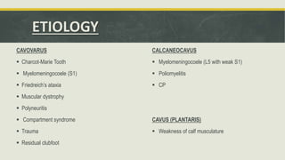 ETIOLOGY
CAVOVARUS
 Charcot-Marie Tooth
 Myelomeningocoele (S1)
 Friedreich’s ataxia
 Muscular dystrophy
 Polyneuritis
 Compartment syndrome
 Trauma
 Residual clubfoot
CALCANEOCAVUS
 Myelomeningocoele (L5 with weak S1)
 Poliomyelitis
 CP
CAVUS (PLANTARIS)
 Weakness of calf musculature
 