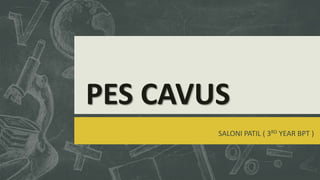 PES CAVUS
SALONI PATIL ( 3RD YEAR BPT )
 