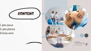 1. pes cavus
2. pes planus
3.Coxa vara
 