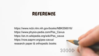 https://www.ncbi.nlm.nih.gov/books/NBK556016/
https://www.physio-pedia.com/Pes_Cavus
https://en.m.wikipedia.org/wiki/Pes_cavus
https://now.aapmr.org/pes-cavus/
research paper & orthopedic books
 