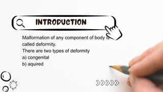 Malformation of any component of body is
called deformity.
There are two types of deformity
a) congenital
b) aquired
 