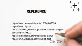 https://www.theseus.fi/handle/10024/807633
https://www.physio-
pedia.com/Pes_Planushttps://www.ncbi.nlm.nih.gov/
books/NBK430802/
https://radiopaedia.org/articles/pes-planus
https://en.m.wikipedia.org/wiki/Flat_feet
 