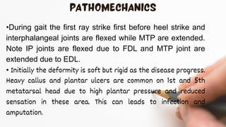 •During gait the first ray strike first before heel strike and
interphalangeal joints are flexed while MTP are extended.
Note IP joints are flexed due to FDL and MTP joint are
extended due to EDL.
• Initially the deformity is soft but rigid as the disease progress.
Heavy callus and plantar ulcers are common on 1st and 5th
metatarsal head due to high plantar pressure and reduced
sensation in these area. This can leads to infection and
amputation.
 