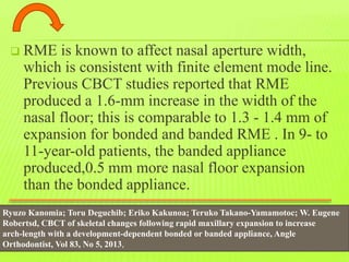 Fme Before And After HOW to measure CBCT BEFORE AND AFTER MID PALATAL SUTURE OPENING | PPTX