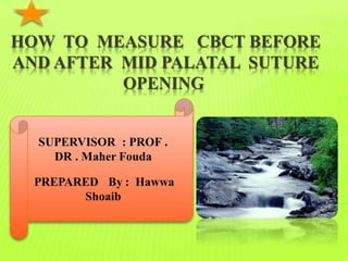 HOW TO MEASURE CBCT BEFORE
AND AFTER MID PALATAL SUTURE
OPENING
..
 