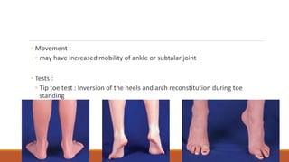 ◦ Movement :
◦ may have increased mobility of ankle or subtalar joint
◦ Tests :
◦ Tip toe test : Inversion of the heels and arch reconstitution during toe
standing
 