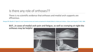 Is there any role of orthoses??
There is no scientific evidence that orthoses and medial arch supports are
efficacious.
BUT…in cases of medial arch pain and fatigue, as well as cramping at night the
orthoses may be helpful.
Wenger DR, Mauldin D, Speck G, et al: Corrective shoes and inserts as treatment for flexible flatfoot in infants and children, J Bone Joint Surg Am 71:800, 1989.
 