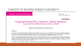CONCEPT OF REVERSE PONSETI CASTING??
 