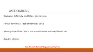 ASSOCIATIONS
Cavovarus deformity and talipes equinovarus
Fibular hemimelia: “ball-and-socket” ankle
Nievergelt-pearlman Syndrome: massive tarsal and carpal coalitions
Apert Syndrome
Tachdjian’sPediatricOrthopaedics,5th edition
 