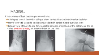 IMAGING..
X ray : views of feet that are performed are :
45 degree lateral to medial oblique view: to visualise calcanenavicular coalition
Harris view : to visualise talocalcaneal coalition across medial subtalar joint
Lateral view of foot : to see for elongated anterior projection of the calcaneus, the so-
called anteater’s nose, an anterior beak on the talus
 