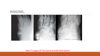 IMAGING..
Mann’s Surgery Of The Foot And Ankle Ninth Edition
 