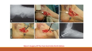 Mann’s Surgery Of The Foot And Ankle Ninth Edition
 