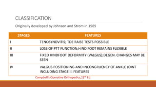 CLASSIFICATION
Originally developed by Johnson and Strom in 1989
STAGES FEATURES
I TENOSYNOVITIS; TOE RAISE TESTS POSSIBLE
II LOSS OF PTT FUNCTION;HIND FOOT REMAINS FLEXIBLE
III FIXED HINDFOOT DEFORMITY (VALGUS);DEGEN. CHANGES MAY BE
SEEN
IV VALGUS POSITIONING AND INCONGRUENCY OF ANKLE JOINT
INCLUDING STAGE III FEATURES
Campbell’s Operative Orthopedics,12th Ed.
 