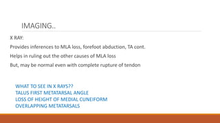 IMAGING..
X RAY:
Provides inferences to MLA loss, forefoot abduction, TA cont.
Helps in ruling out the other causes of MLA loss
But, may be normal even with complete rupture of tendon
WHAT TO SEE IN X RAYS??
TALUS FIRST METATARSAL ANGLE
LOSS OF HEIGHT OF MEDIAL CUNEIFORM
OVERLAPPING METATARSALS
 