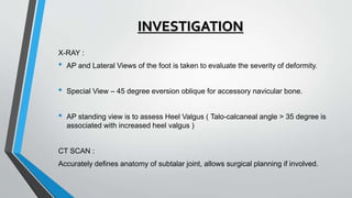 INVESTIGATION
X-RAY :
• AP and Lateral Views of the foot is taken to evaluate the severity of deformity.
• Special View – 45 degree eversion oblique for accessory navicular bone.
• AP standing view is to assess Heel Valgus ( Talo-calcaneal angle > 35 degree is
associated with increased heel valgus )
CT SCAN :
Accurately defines anatomy of subtalar joint, allows surgical planning if involved.
 
