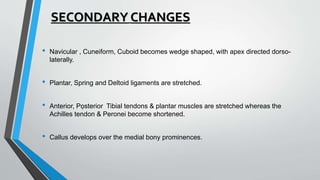 SECONDARY CHANGES
• Navicular , Cuneiform, Cuboid becomes wedge shaped, with apex directed dorso-
laterally.
• Plantar, Spring and Deltoid ligaments are stretched.
• Anterior, Pọsterior Tibial tendons & plantar muscles are stretched whereas the
Achilles tendon & Peronei become shortened.
• Callus develops over the medial bony prominences.
 