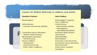 Causes of Flat foot
Paedatric
flatfoot
Adult
flatfoot
 