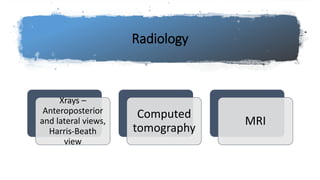 Radiology
Xrays –
Anteroposterior
and lateral views,
Harris-Beath
view
Computed
tomography
MRI
 