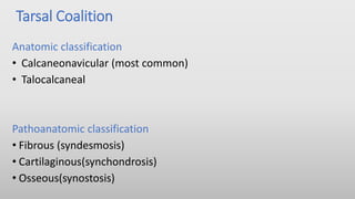 Tarsal Coalition
Anatomic classification
• Calcaneonavicular (most common)
• Talocalcaneal
Pathoanatomic classification
• Fibrous (syndesmosis)
• Cartilaginous(synchondrosis)
• Osseous(synostosis)
 