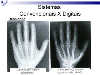 Sistemas
Convencionais X Digitais
Definição:
Densidade
 