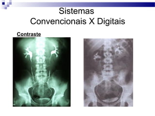 Sistemas
Convencionais X Digitais
Contraste
 