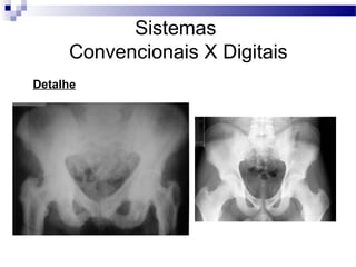 Sistemas
Convencionais X Digitais
Detalhe
 