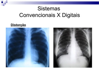 Sistemas
Convencionais X Digitais
Distorção
 