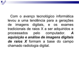      
      Com  o  avanço  tecnológico  informática 
levou  a  uma  tendência  para  a  gerações 
de  imagens  digitais,  e  os  exames 
tradicionais de raios X a ser adquiridos e 
processados  pelo  computador.  A
aquisição e análise de imagens digitais
de raios X  formam  a  base  do  campo 
chamado radiologia digital. 
 