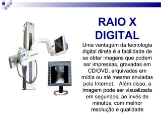 RAIO X
DIGITAL
Uma vantagem da tecnologia 
digital direta é a facilidade de 
se obter imagens que podem 
ser impressas, gravadas em 
CD/DVD, arquivadas em 
mídia ou até mesmo enviadas 
pela Internet.   Além disso, a 
imagem pode ser visualizada 
em segundos, ao invés de 
minutos, com melhor 
resolução e qualidade
 
