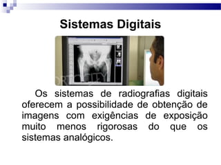   
      Os  sistemas  de  radiografias  digitais 
oferecem a possibilidade de obtenção de 
imagens  com  exigências  de  exposição 
muito  menos  rigorosas  do  que  os 
sistemas analógicos. 
Sistemas Digitais
 